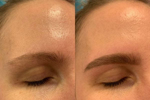 fair eyebrows before and after