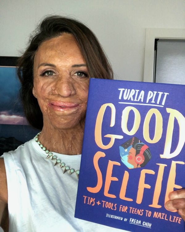 turia pitt good selfie